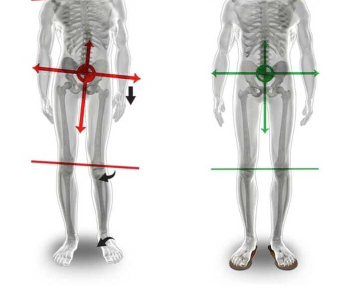 LA POSTURA & L'OSTEOPATIA Studio Osteopatico Moschillo